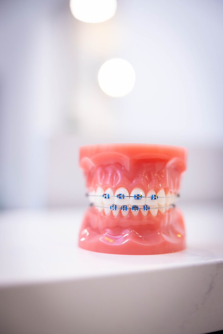 Braces in Hanover, PA & Reisterstown, MD